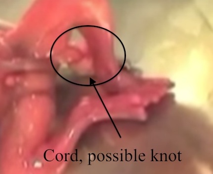 cord knot