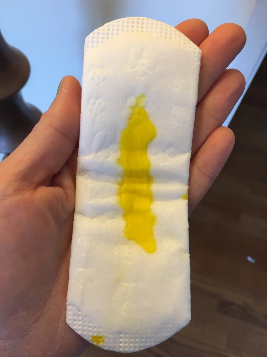 How much vaginal discharge is normal? I made a roux to demonstrate